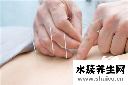 平衡针灸疗法