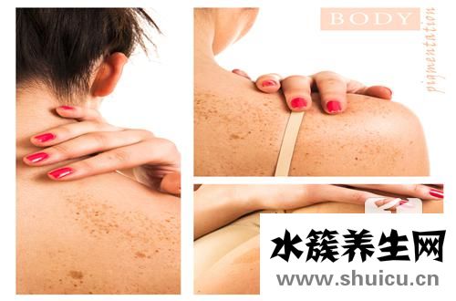 女性得疥疮最初症状有哪些呢