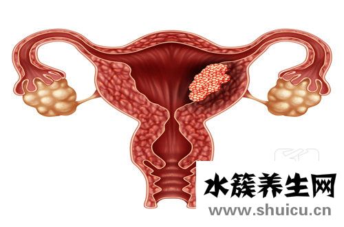 残角子宫