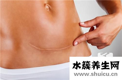 卵巢囊肿是怎么引起的