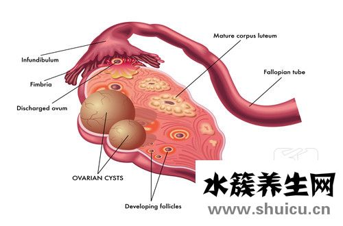 卵巢切除