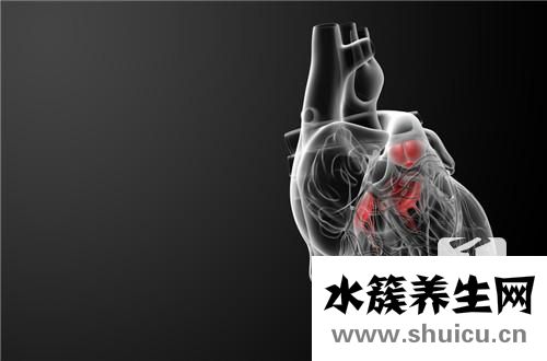 粥样硬化