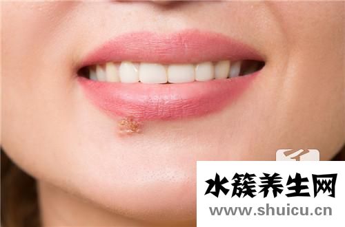 病毒感染吃什么药