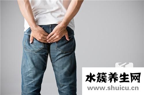 炎性外痔