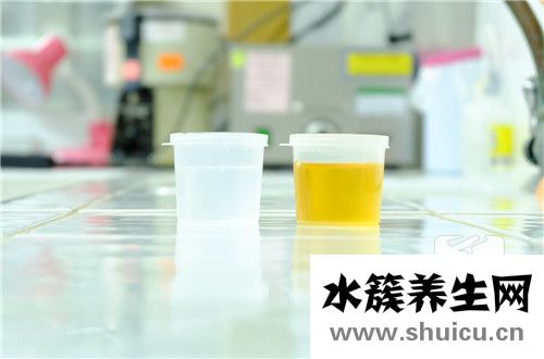 尿比重偏高