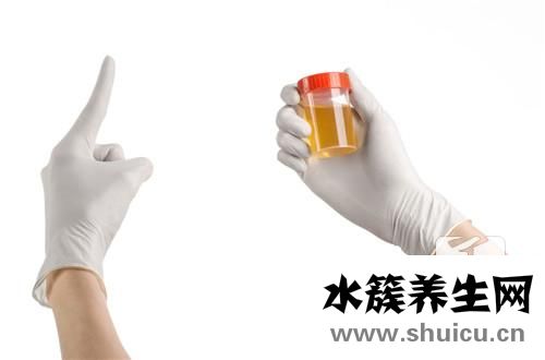 尿结晶