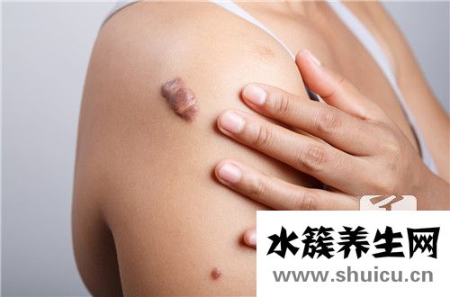 皮下长疙瘩