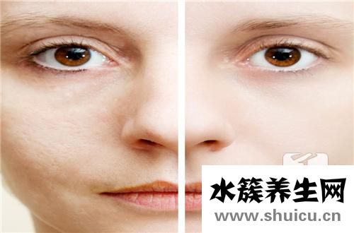 脸上的斑是怎么形成的