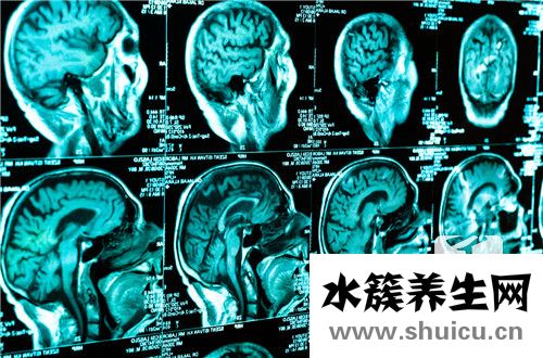 脑动脉瘤手术成功率