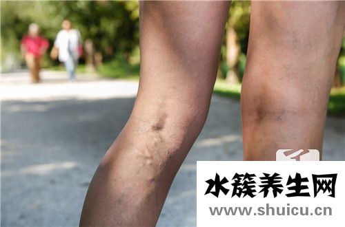 上腔静脉