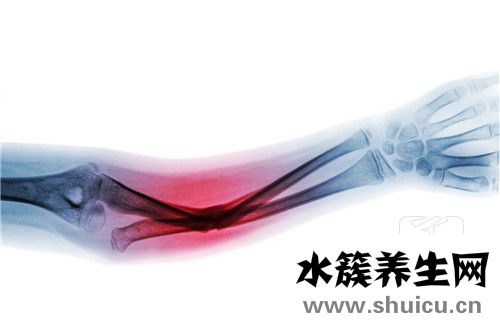 肘管综合征