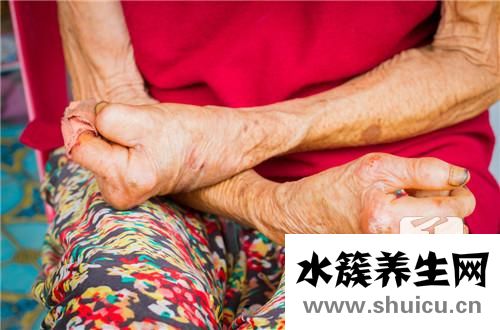 麻风杆菌