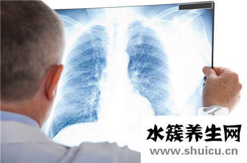 浸润型肺结核