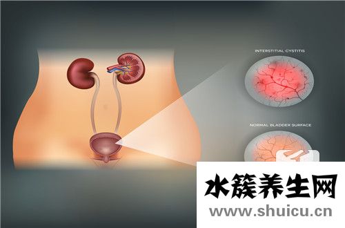 七窍
