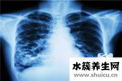 肺结节是怎么回事