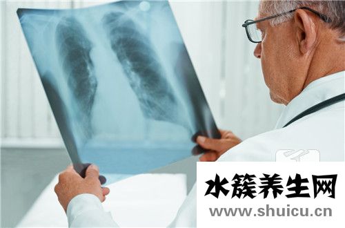 肺结节是怎么回事
