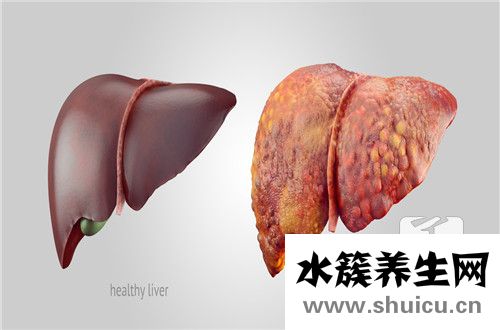 脂肪肝的饮食调养