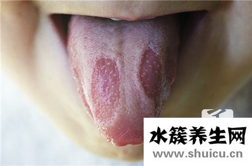 舌头痛是什么原因