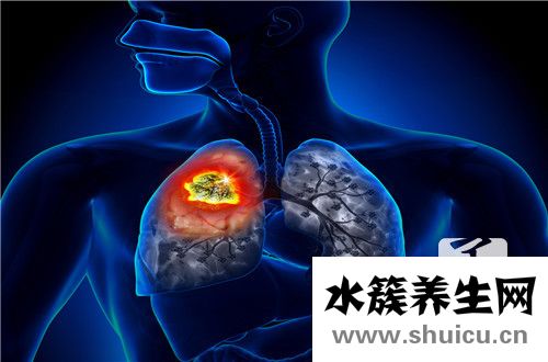 癌症晚期死前征兆