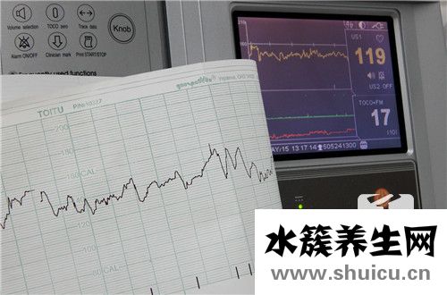 双硫仑反应