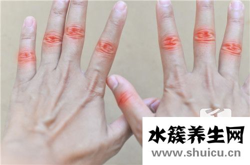 毛囊炎疙瘩怎么治疗