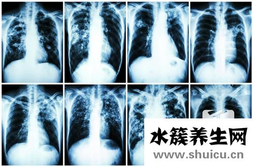 肺部有阴影怎么回事