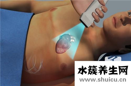 脉络丛囊肿