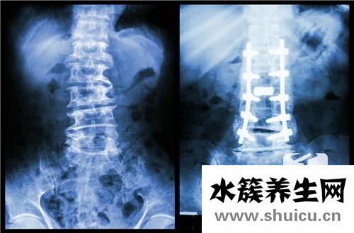 平躺睡觉腰疼怎么回事