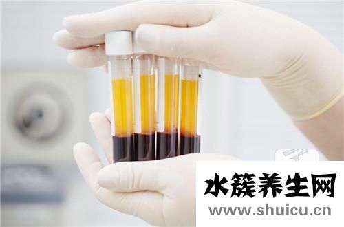 血清胆红素