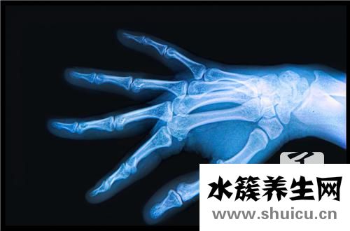 骨折后怎样恢复得快