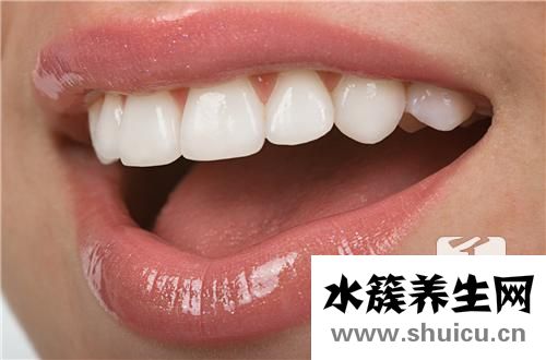 牙套的种类