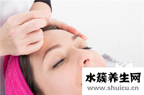 静脉留置针