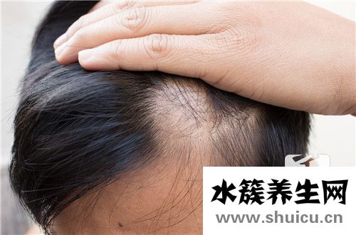 鬼剃头最快的治疗方法