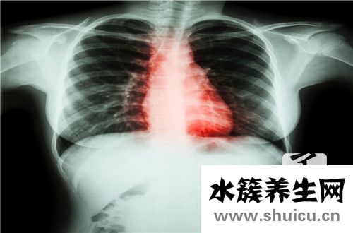 心脏瓣膜关闭不全