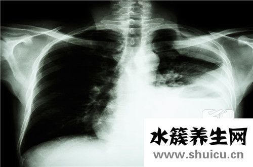 中性细胞比率偏低
