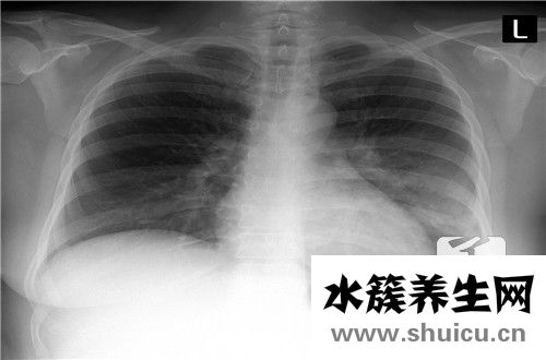 创伤骨科