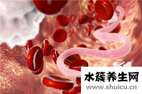 肝吸虫病症状