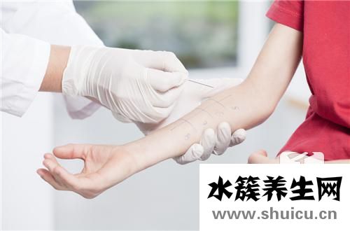 痤疮怎样治疗