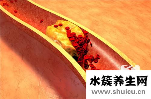 视黄醇结合蛋白偏低