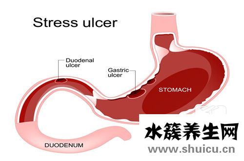 怎么健脾胃最快最有效