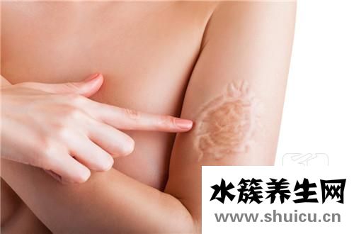 像素激光去疤