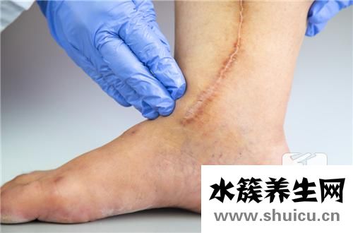 像素激光去疤