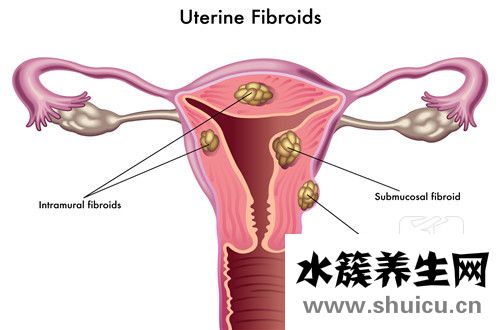 子宫内膜薄吃什么好