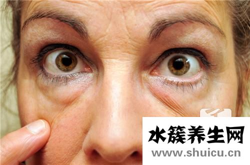 眼袋切除术