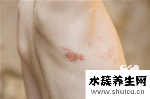 治疗疼痛