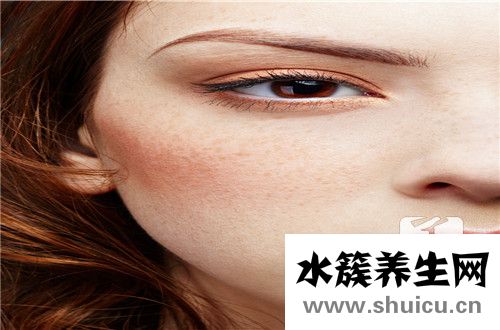 黄褐斑是什么原因