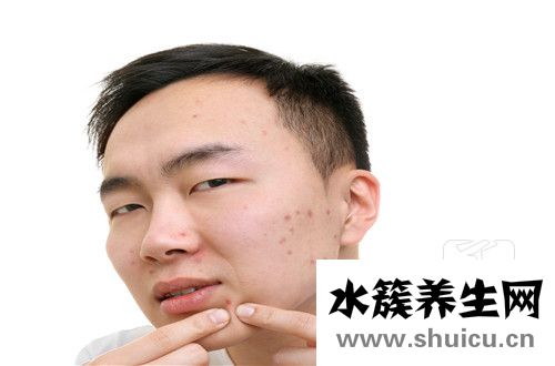 脂溢性痤疮