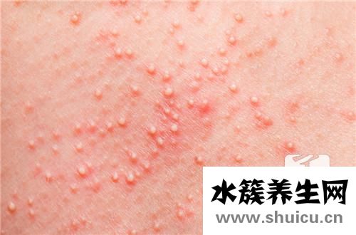 肛门里面有小米粒疙瘩是怎么了？
