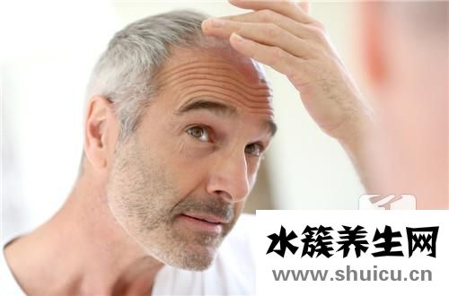 治疗脂溢性脱发