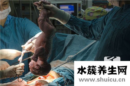 剖腹产疤痕修复